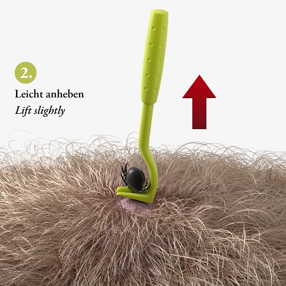 Bodypin, Insektenzange, Haartrimmer, Haarentfernung, Kopfhaut trocknen